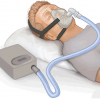 CPAP